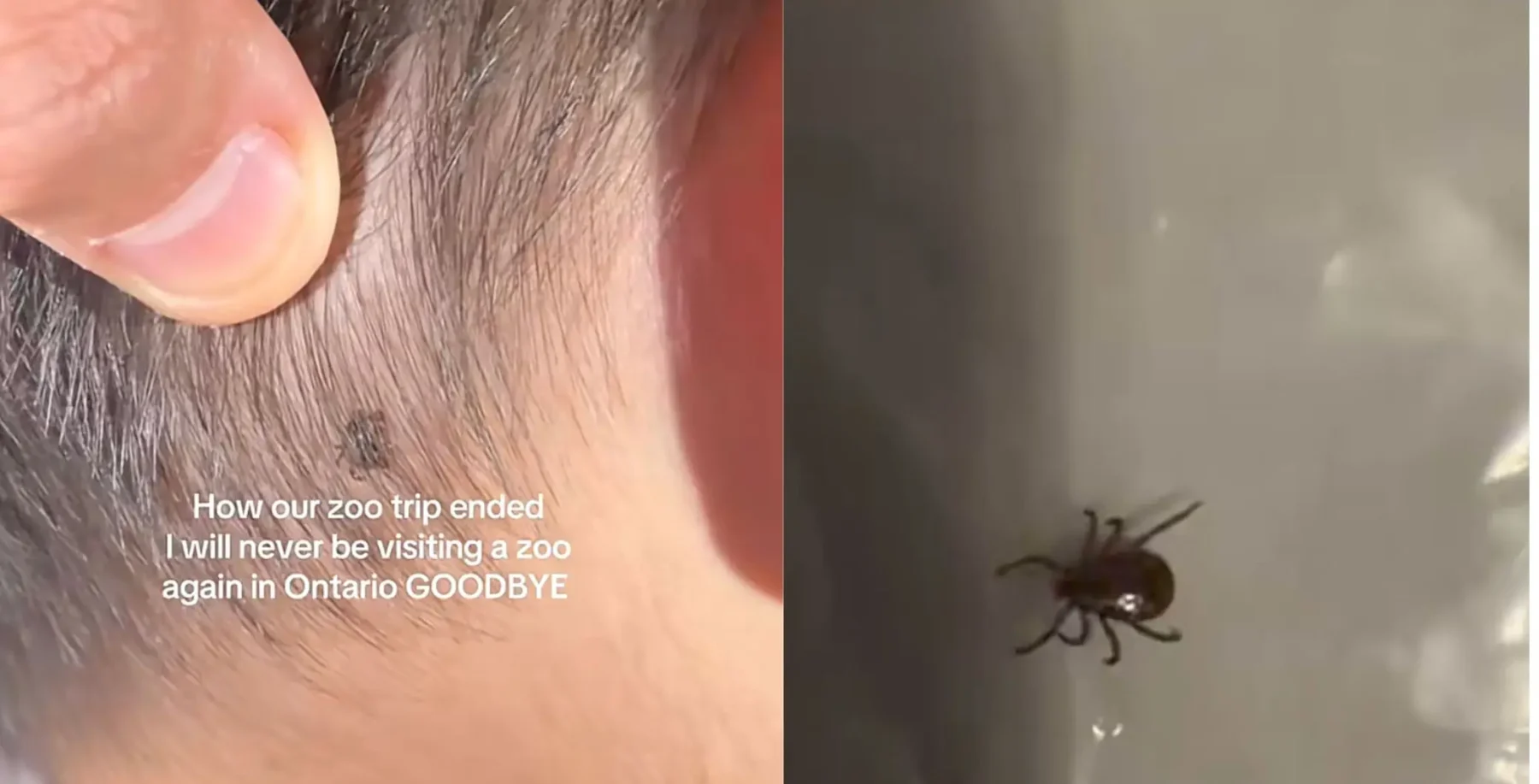 Close-up of a child's neck with a tick on the skin, highlighting tick exposure and safety awareness for parents in Ontario.